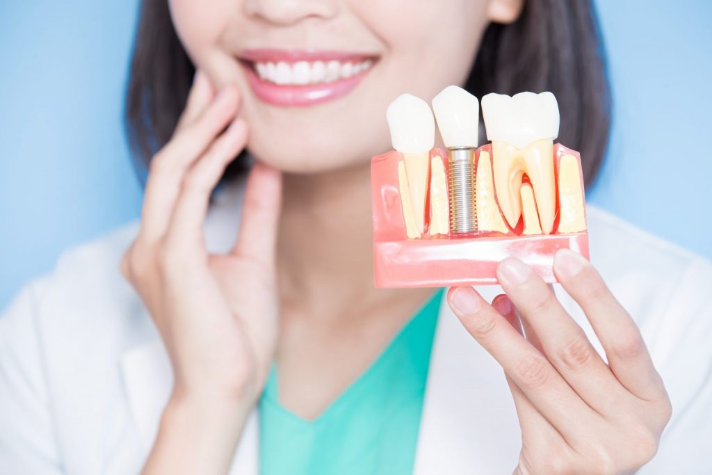 تاثیر سن بر ایمپلنت دندان