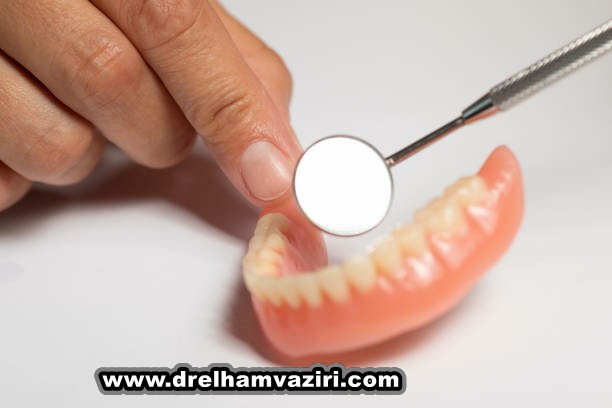 ایمپلنت دندان بهترین راه حل جایگزینی دندان
