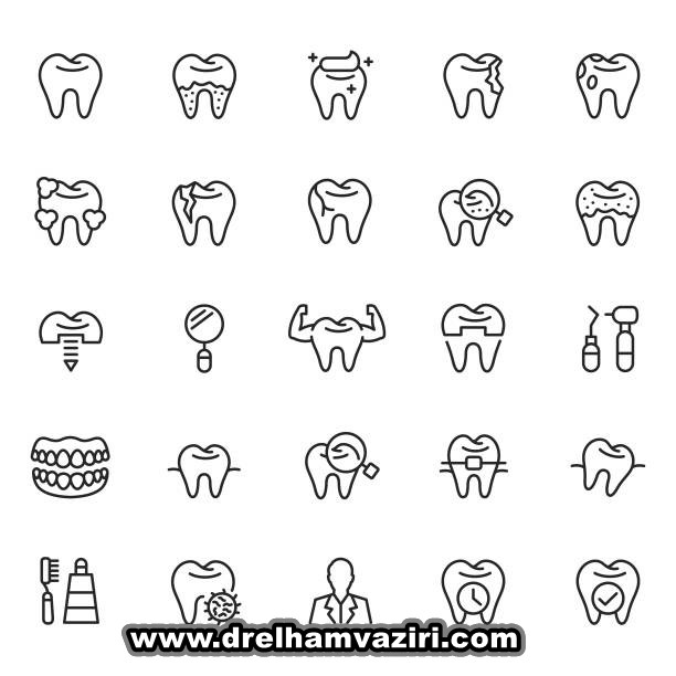  پوکی استخوان و ایمپلنت های دندانی