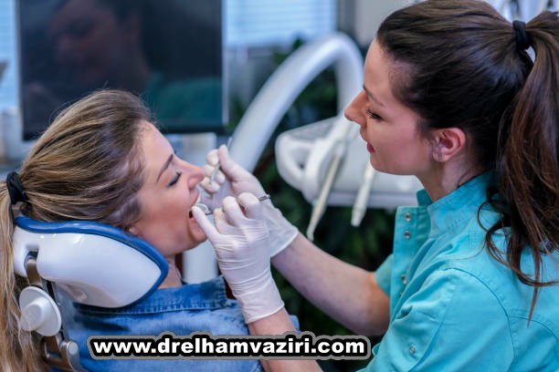پل ایمپلنت دندان چیست