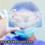 چرا باید ایمپلنت دندان در کلینیک دکتر الهام وزیری را انتخاب کنم
