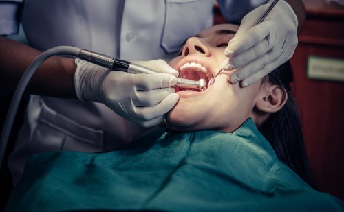 جراحی دندان عقل