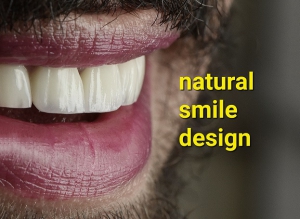 بهترین-دندان-پزشک-سعادت-آباد-